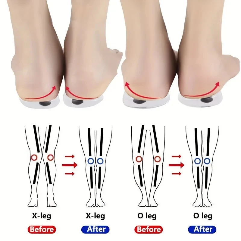 1Pair Orthopedic Insoles for F - огляд і ціна Women Shoes Types