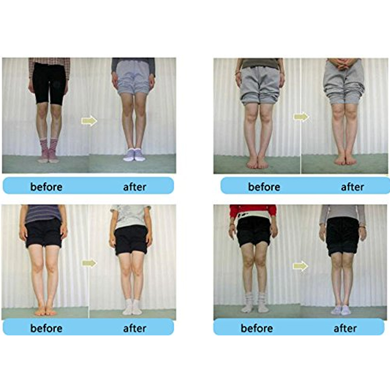 Tcare 1Pair Orthopedic Insoles - огляд і ціна Women Shoes Types